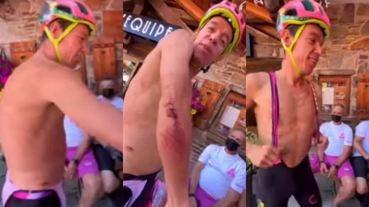 Rigoberto Urán y las heridas en el Tour de Francia 2022