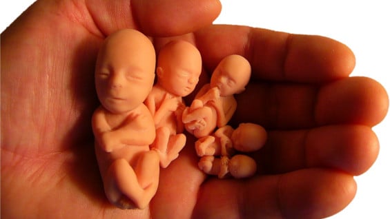 El aborto es legal sin restricciones en Cuba, Puerto Rico, Guyana, Guayana Francesa y Uruguay. Foto: Freeimages
