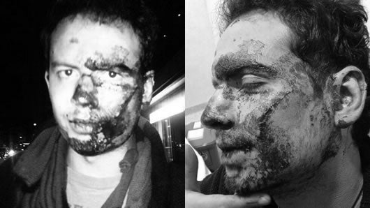 El universitario resultó con cuatro fracturas en el rostro y necesita varias cirugías. Foto. @JGranadosPena