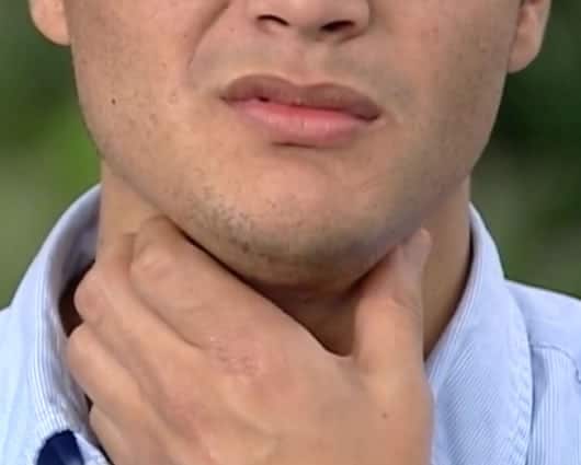 Los niños están más propensos a padecer la enfermedad.