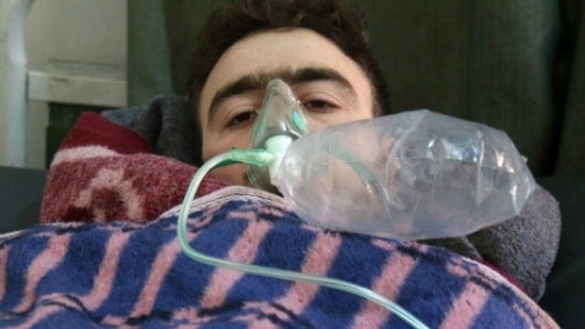 Un hombre recibe tratamiento médico tras un ataque químico contra la localidad de Jan Shijún, en el sur de la provincia septentrional de Idleb. Foto: AFP.