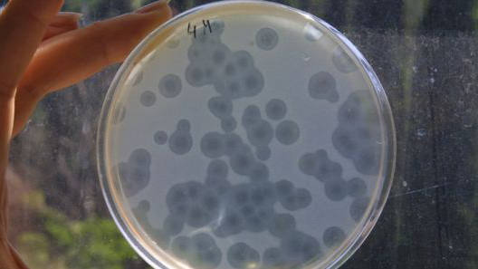 La infección por la bacteria puede ocasionar úlceras en la piel. Foto: AFP.