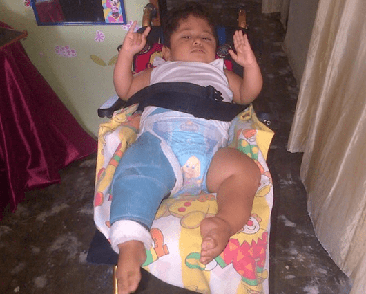 Johan David recibió la silla que necesitaba y además fue operado.