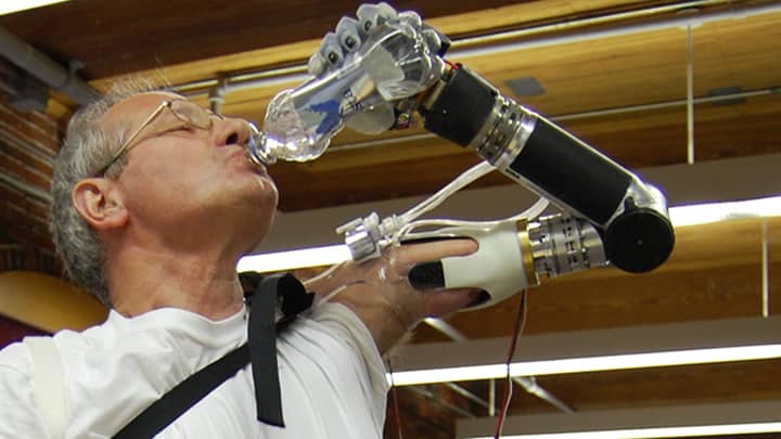 La empresa aún no ha revelado el costo del brazo robótico. Foto: oficial