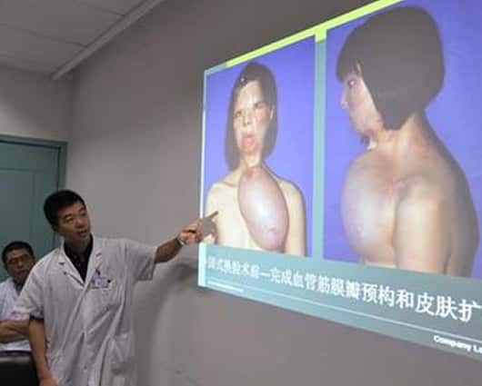 Xu Jianmei. Foto: internet