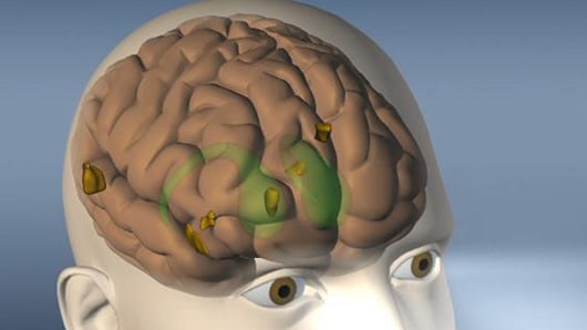 Según el estudio, la edad en la que el cerebro consume más energía es cuando los niños menos crecen. Foto: AFP.
