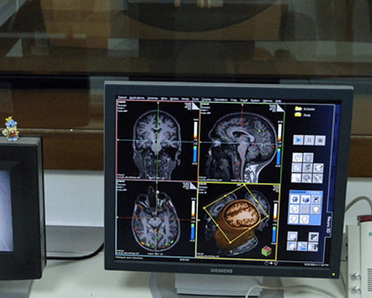 La investigación contó con la mayor muestra de sujetos empleada hasta el momento para el estudio de las bases moleculares del alzhéimer. Foto: AFP