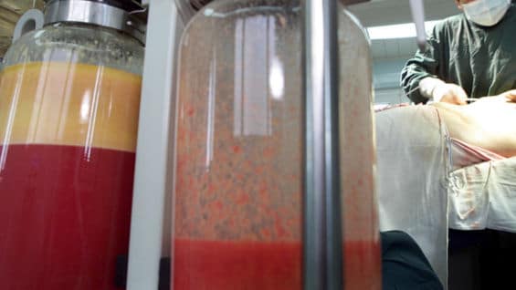 Cirugía estética. Foto: Liu Jin/AFP