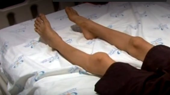 Menor de nueve años en estado de desnutrición. Foto:NoticiasRCN