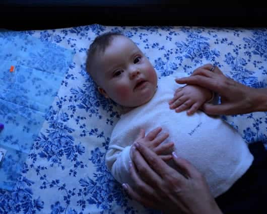 El gen XIST podría corregir la trisomía del cromosoma 21 que causa la enfermedad. Foto: AFP