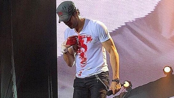 El cantante siguió cantando a pesar de las heridas. Foto: @JoeBonilla.