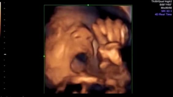 Las imágenes han causado gran asombro entre los usuarios. Foto: Noticias RCN.