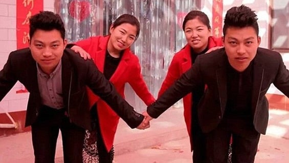 Los gemelos decidieron someterse a una cirugía para evitar confusiones. Foto: Twitter.