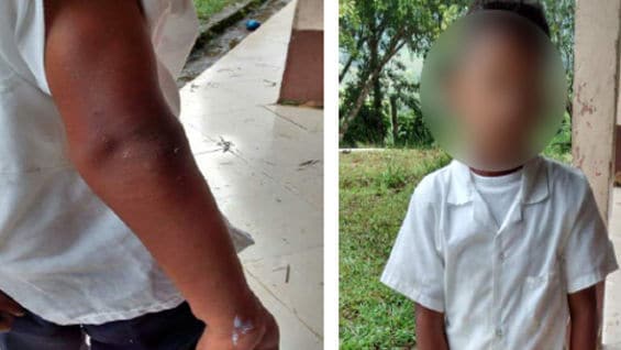 Foto de la Defensoría de menor afectado.