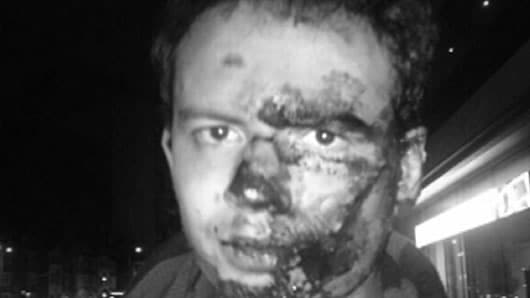 La Fiscalía evalúa el video de instantes previos a la golpiza a Vargas.