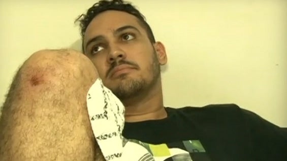 El joven de 20 años permanece hospitalizado Foto: Noticias RCN