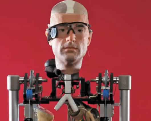 Al hombre biónico aún le faltan el cerebro, el hígado y el estomago.