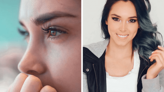 Kika Nieto revela su drama con el acné y cómo logró superarlo