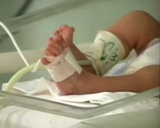 La bebé sufrió dos paros respiratorios y el tercero le produjo la muerte.