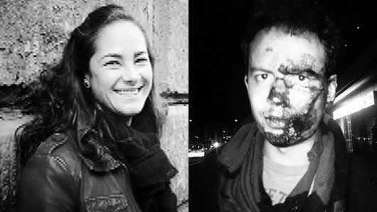 El de Natalia Ponce y Alejandro Vargas son dos de los casos más sonados de lesiones personales.