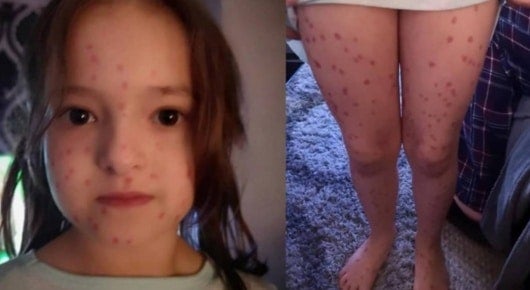 FOTO: NoticiasRCN.com