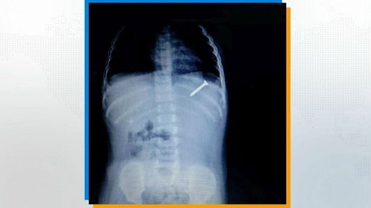 Foto: NoticiasRCN.com