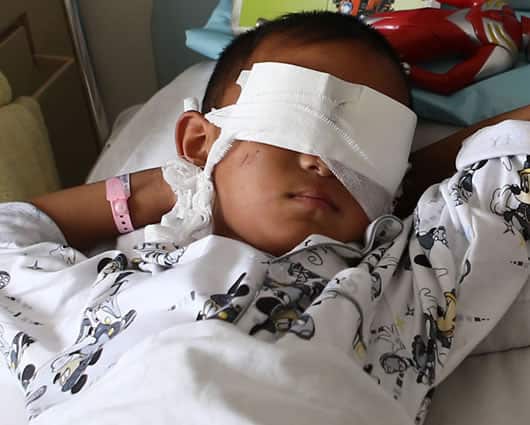 Los ojos del niño fueron encontrados sin las córneas. Foto: AFP