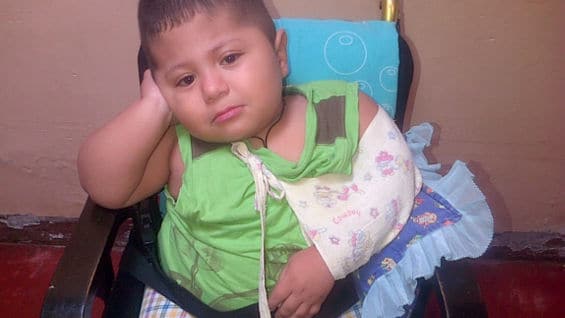 Johan David sufre osteogénesis imperfecta. Foto: archivo personal.