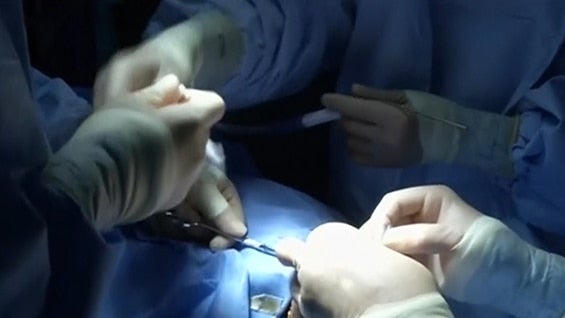 Religiosos y cirujanos comparten que el cuerpo debe ser menos vendido y se deben evitar los estereotipos.