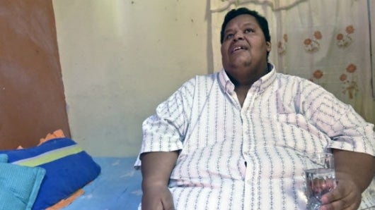 Óscar Vásquez, con 400 kilos, llegó a ser el hombre más obeso de Colombia. Foto Agencia AFP