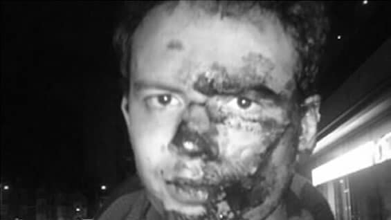 Alejandro Vargas tras la riña.