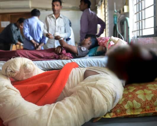 El INS informó que la cifra de quemados bajo. Foto: Archivo AFP