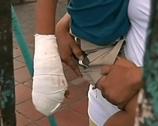 126 menores de edad han sido víctimas de quemaduras con pólvora.