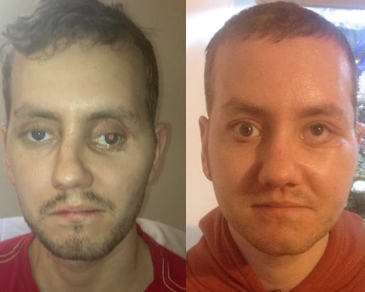 En un accidente de tránsito, Power se rompió la mandíbula superior, la nariz, los pómulos y se fracturó el cráneo. Foto: AFP