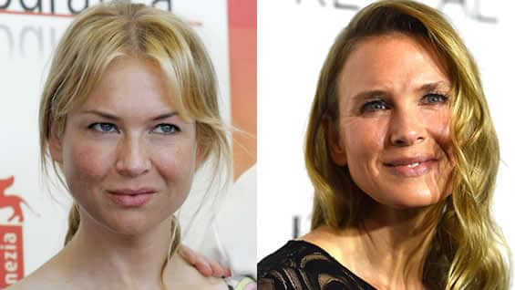 El antes y el después de la actriz Renée Zellweger. Foto: AFP