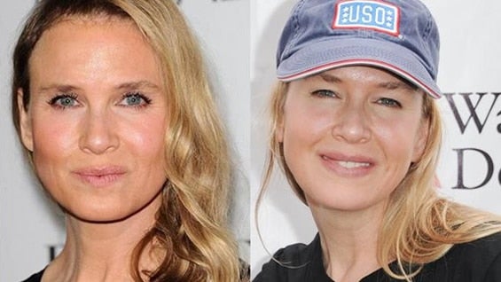 Renée Zellweger lució un rostro tan cambiado hace algunos meses que algunos medios estadounidenses lo calificaron de "virtualmente irreconocible".