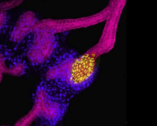 Imagen de uno de los minirriñones. Foto: EFE