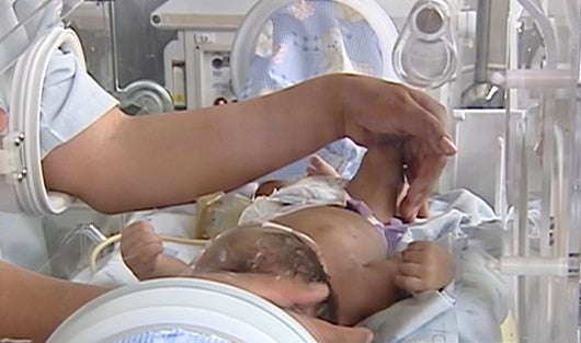 El sistema respiratorio del bebé prematuro es el que más cuidado requiere.