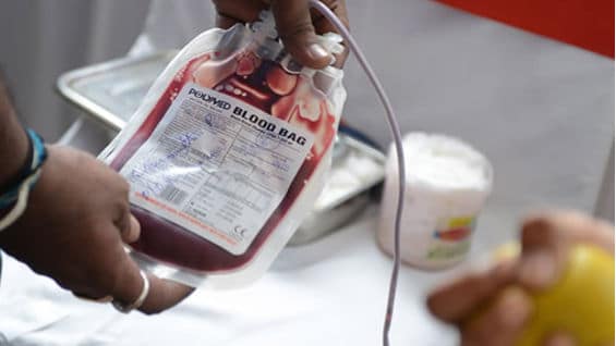 Ambos fueron sometidos a cirugías de trasplante. Foto: AFP.