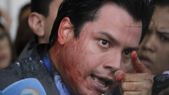 Carlos Paparoni, diputado agredido. Foto: AFP.