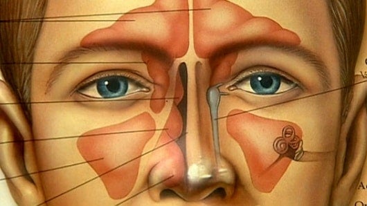 Foto: NoticiasRCN.com