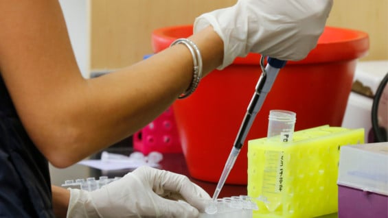 Si el virus está presente, la sustancia reacciona enturbiando el líquido. Foto: Archivo AFP