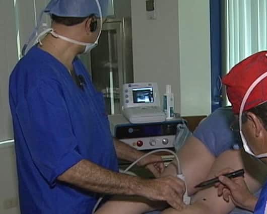 La aparición de la vena várice es uno de los mayores temores de las mujeres.