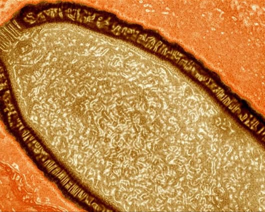 Este virus es capaz de infectar amebas, pero es inofensivo para humanos y animales. Foto: Internet