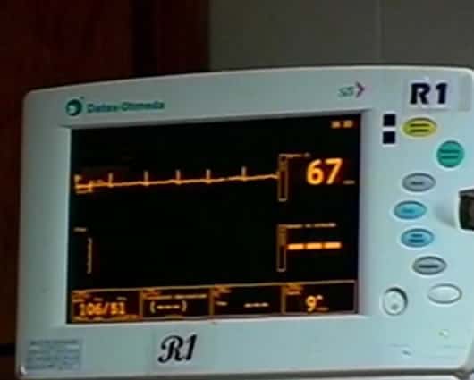 El electrocardiograma del paciente no fue leído por su especialista. Foto: Noticias RCN