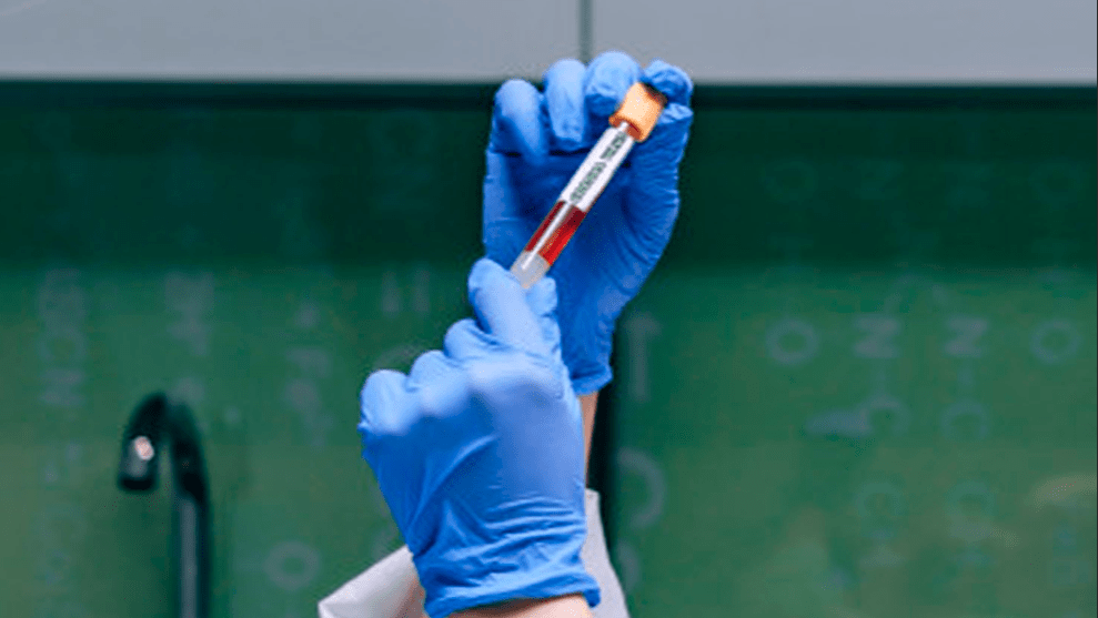 Foto: Archivo particular. test coronavirus