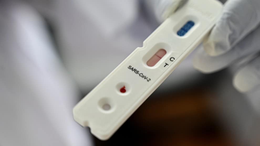 Vacuna contra covid-19 sería un "bien público": comunidad internacional