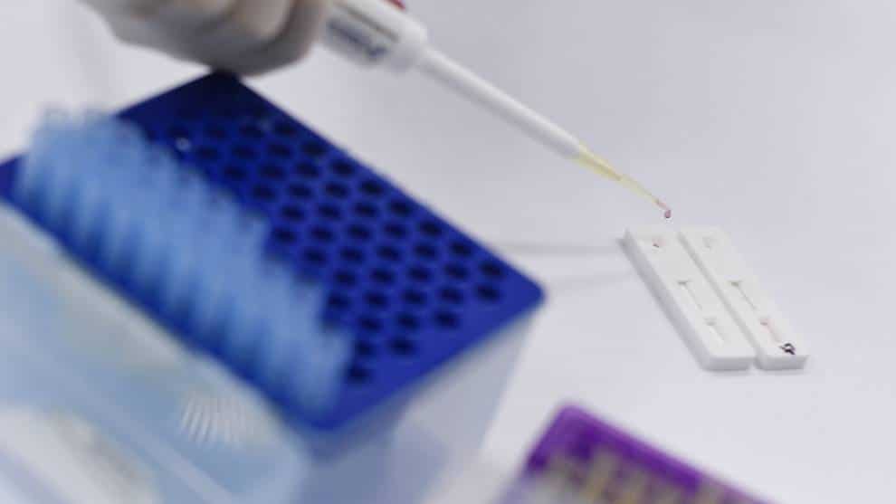 Preparan un millón de dosis de potencial vacuna contra el coronavirus