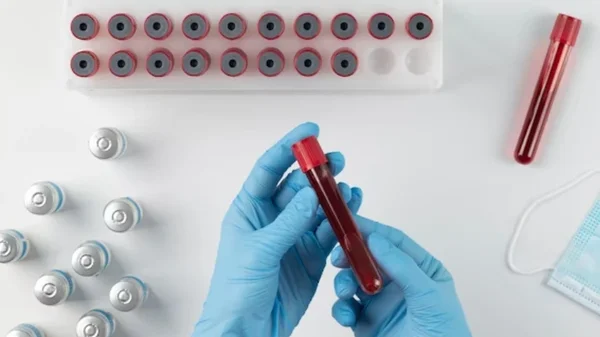 Informe de Unicef reveló que diariamente 30 adolescentes se infectan con VIH en América Latina y el Caribe