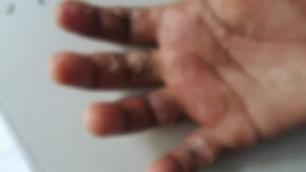 Capturan a madre que habría quemado las manos de su hija de 7 años con la estufa en Tuluá